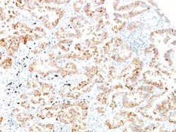 Cytokeratin 7 Antibody (SPM270), Novus Biologicals 0.2mg; Unlabeled:Antibodies,